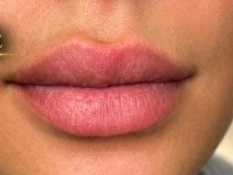 Before: natural lips